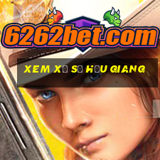 xem xổ số hậu giang