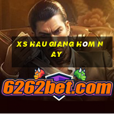 xs hau giang hôm nay