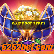 club foot types